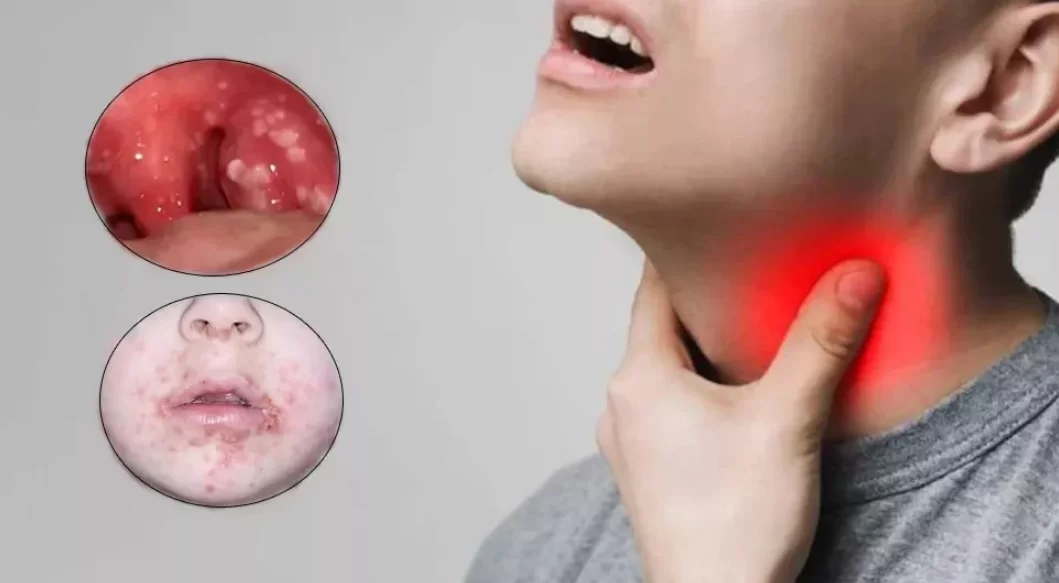 Dirritromisin Nedir?