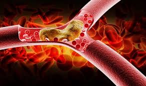 Trigliserid Nedir? Sağlık İçin Önemi ve Kontrol Yöntemleri